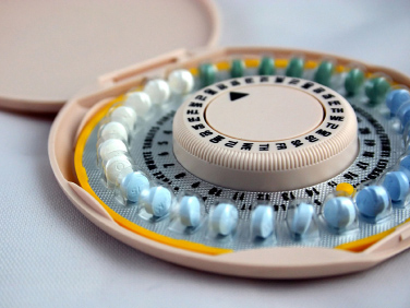 Oralni kontraceptivi dobar izbor za liječenje akni u žena