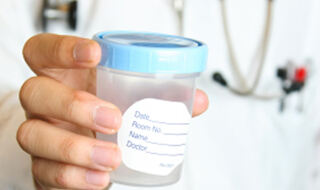 Test urina može pomoći muškarcima da preskoče biopsiju prostate